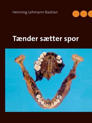 cover image of Tænder sætter spor